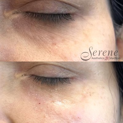 SERENE AESTHETICS & MEDSPA - Updated January 2026 - 51 Photos & 30