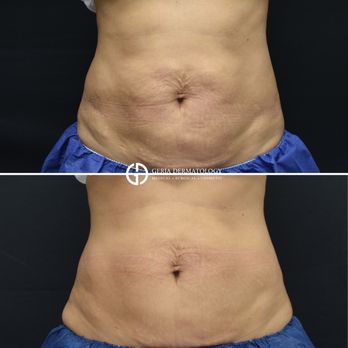 Geria Dermatology - Rutherford - Dermatologists Near Me - Rutherford, New Jersey