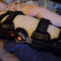 Slocum Center for Orthopedics & Sports Medicine - Tibial Plateau fracture. Surgery was just what the doctor ordered (ha) Slocum handled all the preliminary which was stellar.