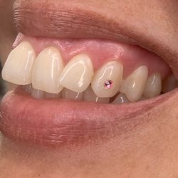 Icy Smile Bar - Baby pink Canine gem