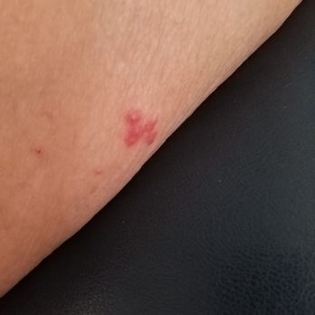 The Porch - Blister Beatle bites from The Porch location on Indian School. - Sports Bars Near Me - Phoenix, Arizona The Porch - Blister Beatle bites from The Porch location on Indian School. - Sports Bars Near Me - Phoenix, Arizona