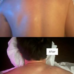 Soothe & Stretch Bodyworks - Elevated shoulder progress after one 60 minute session.