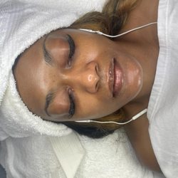 Sage Spa FTL - Post Firefly Facial