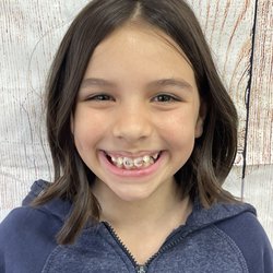Ontario Kids N Braces - First Day