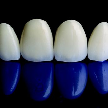 GKY Dental Art - Veneers - Medical Supplies Near Me - Torrance, California GKY Dental Art - Veneers - Medical Supplies Near Me - Torrance, California
