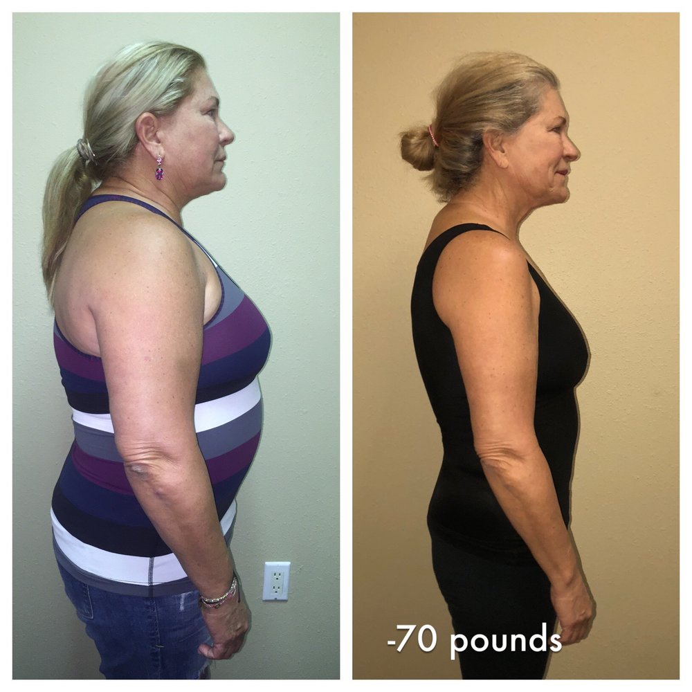 IDEAL WEIGHT LOSS Updated September 2024 913 Gulf Breeze Pkwy, Gulf