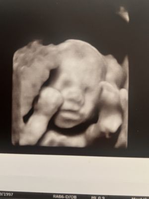 BEACH BUMP 3D 4D IMAGING - Updated July 2026 - 26 Photos - 3659 Cortez ...