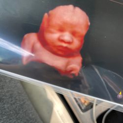 First View Ultrasound Center