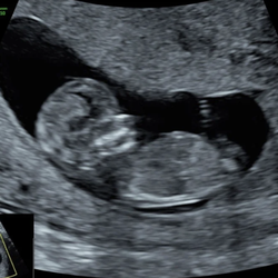 Life in Bloom Sonography Studio 3D/4D Ultrasound Lincoln, NE