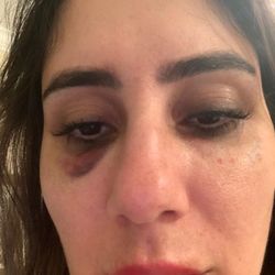 Steven K Struck, MD