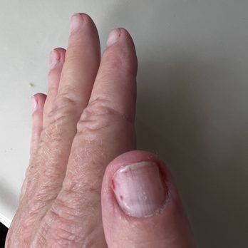 Peace Nails - Very bad manicure!! - Nail Salons Near Me - Mechanicsburg, Pennsylvania Peace Nails - Very bad manicure!! - Nail Salons Near Me - Mechanicsburg, Pennsylvania