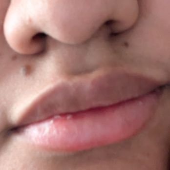 NakedMD - Temecula - Lips - Medical Spas Near Me - Temecula, California NakedMD - Temecula - Lips - Medical Spas Near Me - Temecula, California
