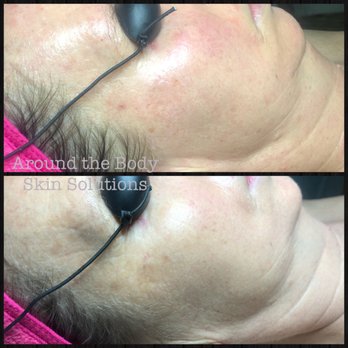 Around the Body Skin Solutions - Rejuvenated - Skin Care Near Me - Naples, Florida Around the Body Skin Solutions - Rejuvenated - Skin Care Near Me - Naples, Florida