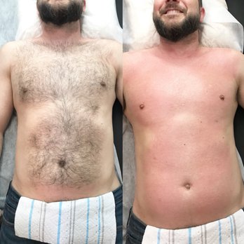 Men Wax Too Slower Hair Growth Last Upto 3 Weeks With No Growth