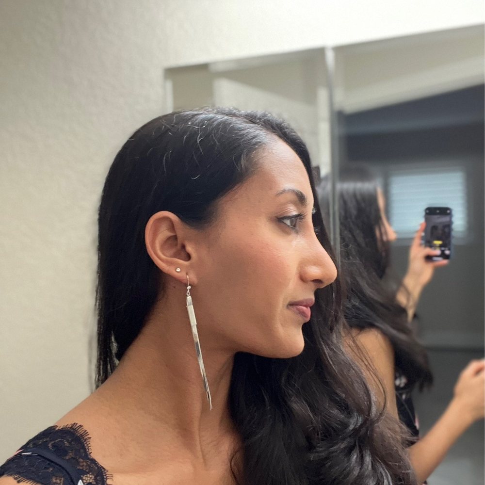 T.Y. Steven Ip, MD - After 3 weeks of rhinoplasty - Cosmetic Surgeons Near Me - Newport Beach, California T.Y. Steven Ip, MD - After 3 weeks of rhinoplasty - Cosmetic Surgeons Near Me - Newport Beach, California