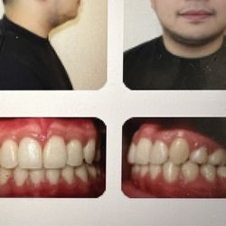 Family Orthodontics & Oral Surgery - Final photos