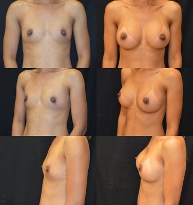 Baroody Plastic Surgery by null