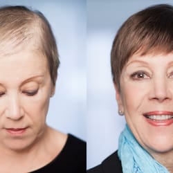 P K Salon - PK Salon offers the EVOLVE Volumizer as a solution to Hair Loss and Thinning Hair
