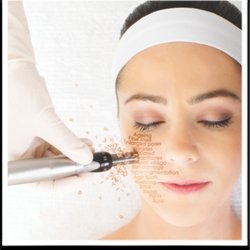 Aesthetic Dermatology of Fairfield County - Https://www.sharonlittzimd.com/medical-dermatology/acne-treatment/microneedling/