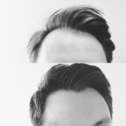 Bosley Hair Restoration & Transplant