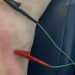 Brambert Chiropractic And Acupuncture