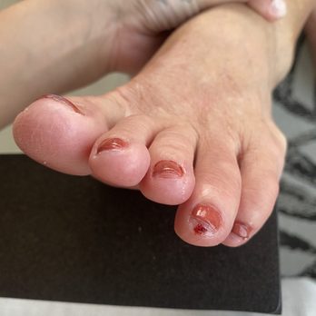 Noire Nail Bar - Cut on toe - Nail Salons Near Me - Venice, Florida Noire Nail Bar - Cut on toe - Nail Salons Near Me - Venice, Florida