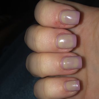 Queen Bee Nail & Spa - nails turned from purple to this in 2 days - Nail Salons Near Me - Hamilton, New Jersey