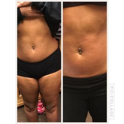 Trim And Slim Day Spa and Body Sculpting 