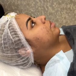 Nuo Advance Aesthetics