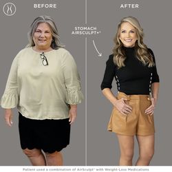 AirSculpt - Las Vegas