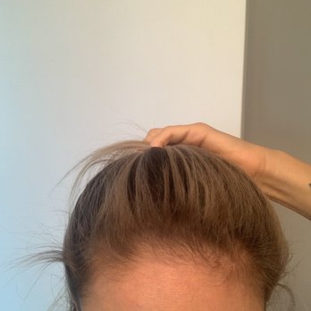 Elite Styles Salon & Med Spa - So much hair fell off - Hair Salons Near Me - Miami, Florida