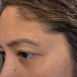 Nicked skin after threading