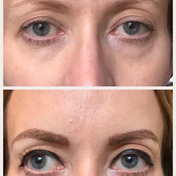 The Color Rad Salon - Micro blades brows before and after - Waxing Near Me - Boulder, Colorado The Color Rad Salon - Micro blades brows before and after - Waxing Near Me - Boulder, Colorado
