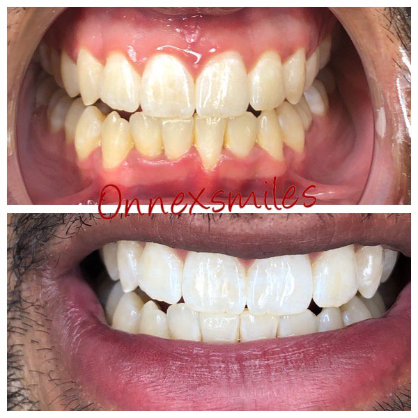 Onnex Smiles Logo