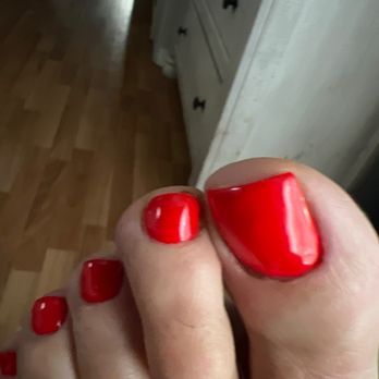 The Best Nails Miami - Raw cuticle's on my toes also! - Nail Salons Near Me - Aventura, Florida The Best Nails Miami - Raw cuticle's on my toes also! - Nail Salons Near Me - Aventura, Florida