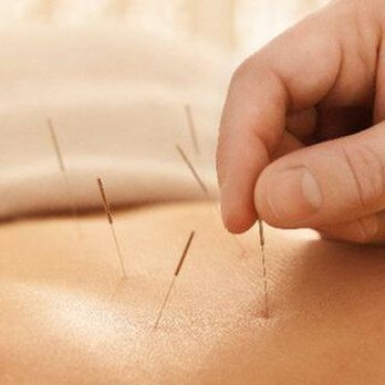 Empire Medicine - untitled - Acupuncture Near Me - Williston Park, New York