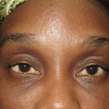 Lorri Cobbins, MD - After without flash - Cosmetic Surgeons Near Me - Chicago, Illinois