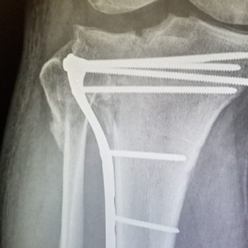Damion J Valletta DO - Thanks Dr. Valeta and team! - Sports Medicine Near Me - San Diego, California Damion J Valletta DO - Thanks Dr. Valeta and team! - Sports Medicine Near Me - San Diego, California
