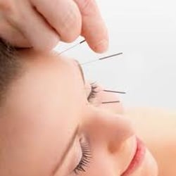 JKB Acupuncture
