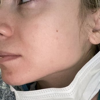 Acne Clinic NYC - Skin Care Near Me - New York, New York Acne Clinic NYC - Skin Care Near Me - New York, New York