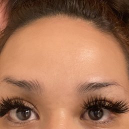 After - 60 units of botox.. these the results 2 weeks later zero filter!!! After - 60 units of botox.. these the results 2 weeks later zero filter!!!
