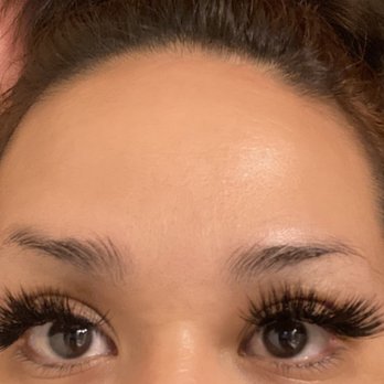 SkinFix Studios - After - 60 units of botox.. these the results 2 weeks later zero filter!!! - Aestheticians Near Me - Scottsdale, Arizona SkinFix Studios - After - 60 units of botox.. these the results 2 weeks later zero filter!!! - Aestheticians Near Me - Scottsdale, Arizona