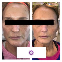 Brunswick Medical Aesthetics