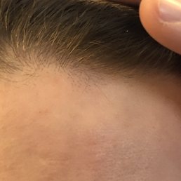 Cut hairline Cut hairline