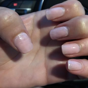 Cool Nails - 2 days after my Fill in. Look how it's filed on top; thumb, index and middle finger & acrylic is missing near my cuticles and the sides. - Nail Salons Near Me - Baldwin, New York