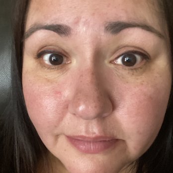 Butterfly Kisses by Aj - After procedure during healing - Permanent Makeup Near Me - Eagle, Idaho Butterfly Kisses by Aj - After procedure during healing - Permanent Makeup Near Me - Eagle, Idaho