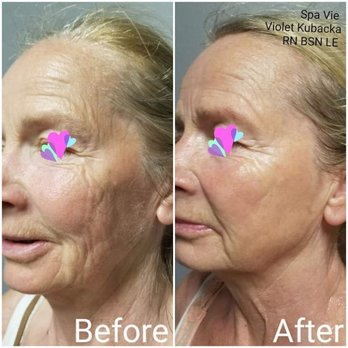Spa Vie - Skin Care Near Me - La Grange, Illinois