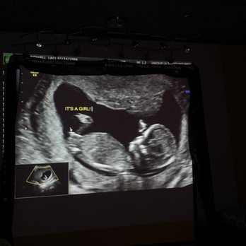 Unique Ultrasound Redlands - Ultrasound Imaging Centers Near Me - Redlands, California