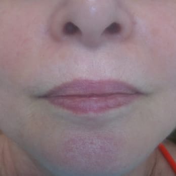 Flawless Permanent Cosmetics - Before Lip Tint - Cosmetic Surgeons Near Me - Chesterfield, Missouri