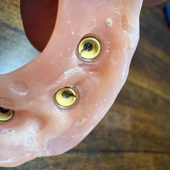 Affordable Dentures & Implants - Hard liner coming off - Prosthodontists Near Me - Georgetown, Texas